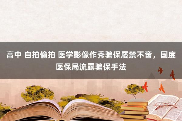 高中 自拍偷拍 医学影像作秀骗保屡禁不啻，国度医保局流露骗保手法